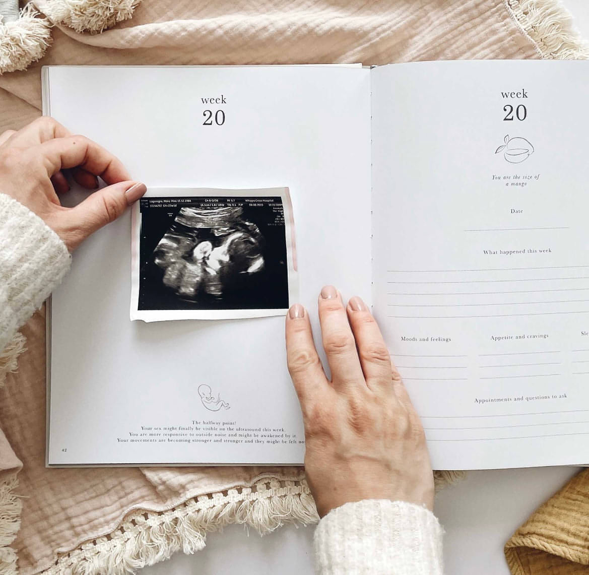 My Pregnancy Journal